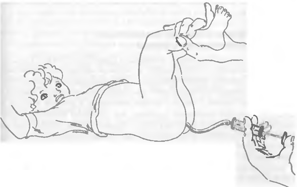 Пальцевое ректальное исследование при аппендиците