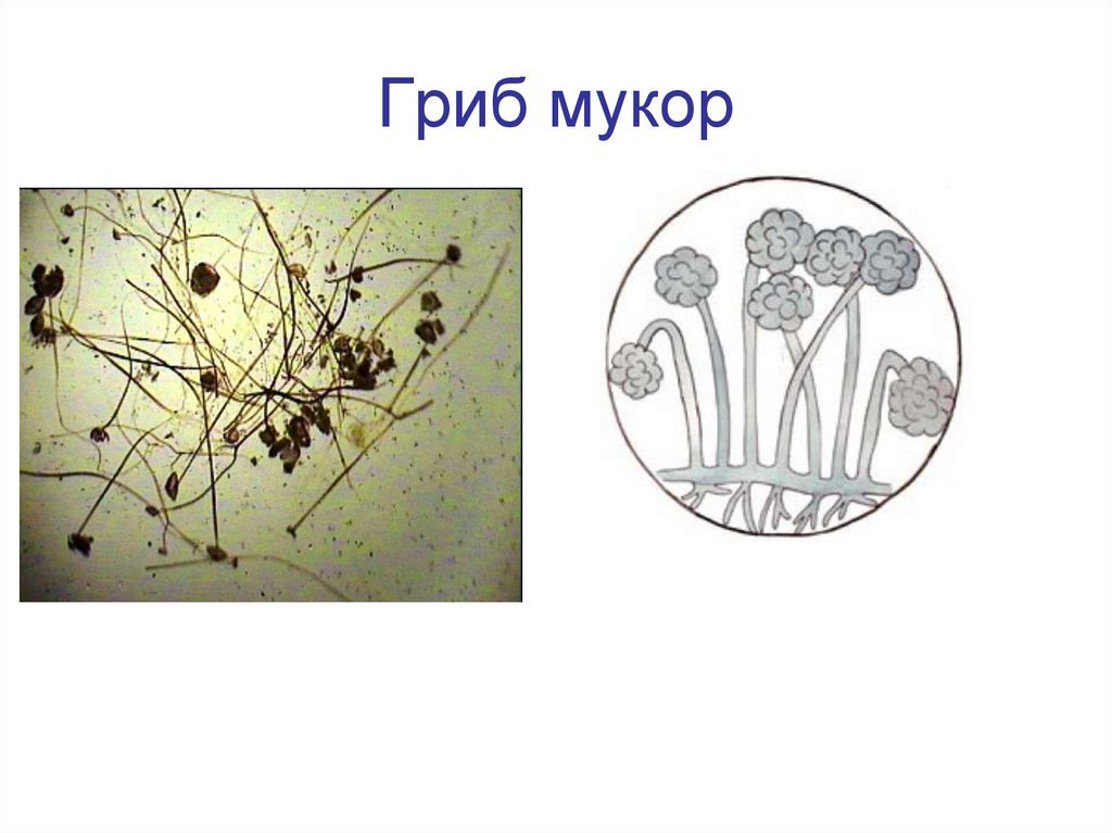 Мукор клетка. Плесневые грибы Mucor. Строение мицелия мукора. Плесень мукор под микроскопом. Плесневелый гриб мукор.