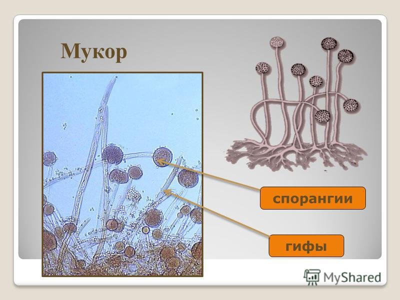 6 мукор. Клетка плесневого гриба мукора. Клетки плесневого гриба мукора под микроскопом. Плесень мукора под микроскопом. Клетка гриба мукора под микроскопом.