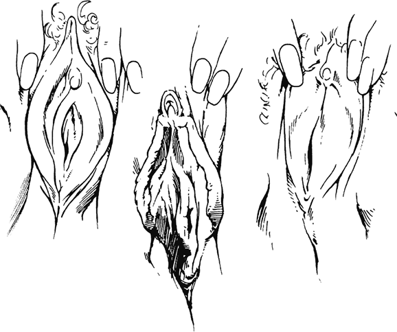 Формы половых органов у женщин