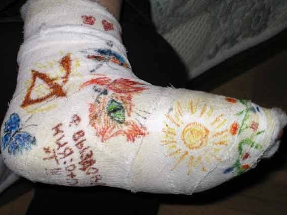 Разукрашенный гипс