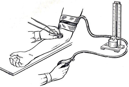 Измерение давления тонометром алгоритм