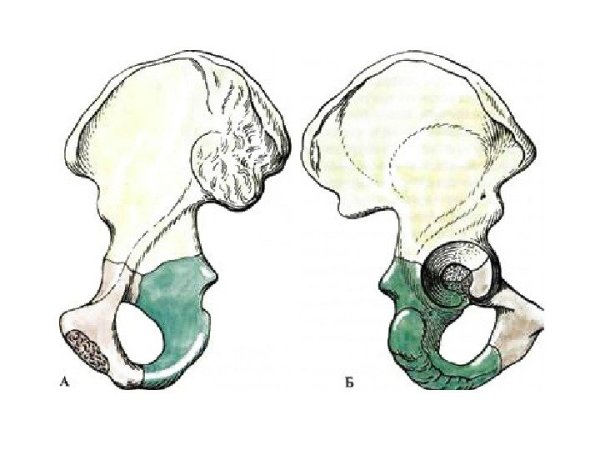 Анатомия костей таза нижних конечностей