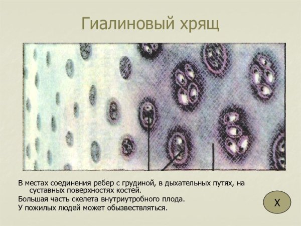 Надхрящница гиалинового хряща