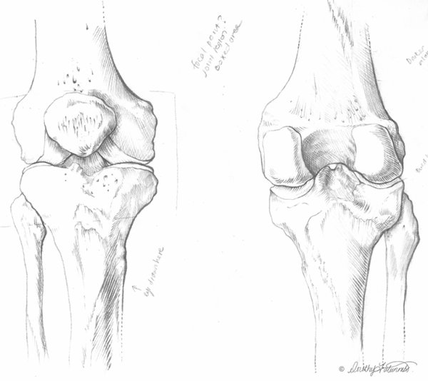 Коленный сустав скелет анатомия