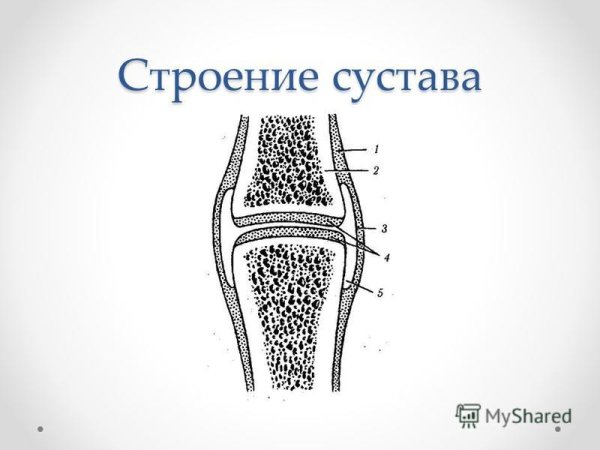 Схема сустава анатомия