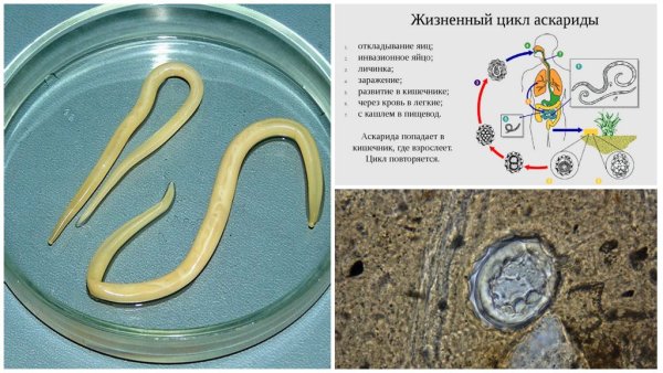 Круглые черви аскарида человеческая