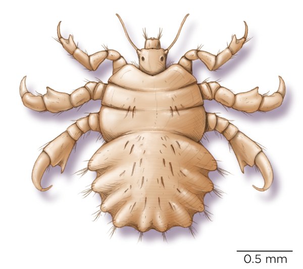Лобковая вошь (Phthirus pubis). Строение