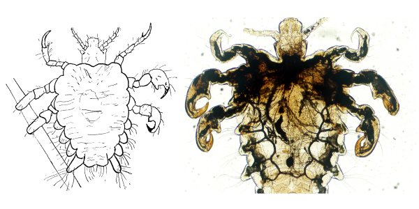 Отряд вши головная вошь