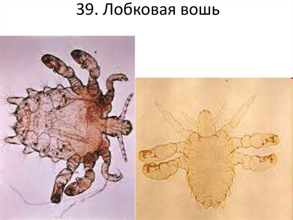 Лобковые вши мандавошки