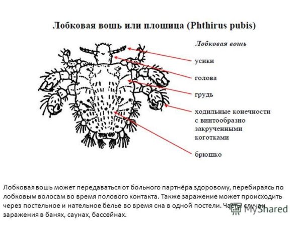 Мандавошки лобковая вошь