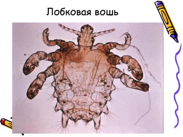Phthirus pubis строение
