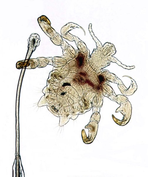 Phthirus pubis строение