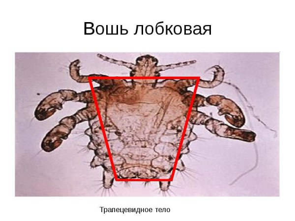 Вши головная платяная лобковая