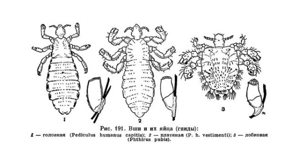 Гнида головной вши строение
