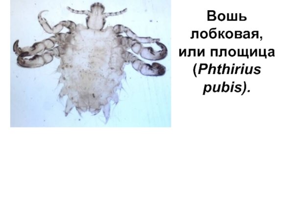 Головная платяная и лобковая вошь