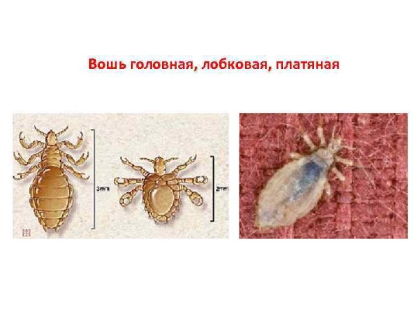 Pediculus humanus humanus самец