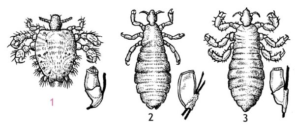Вши головная платяная лобковая