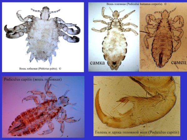 Жизненный цикл лобковой вши