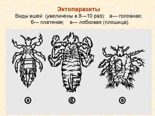 Головная вошь внешнее строение