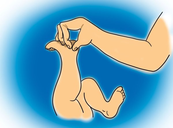 Ахиллесова пята миф древней Греции