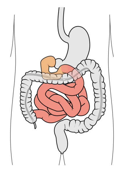 Кишечник человека чб