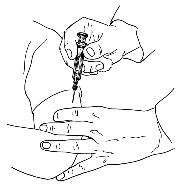 Игла для внутрикожной инъекции