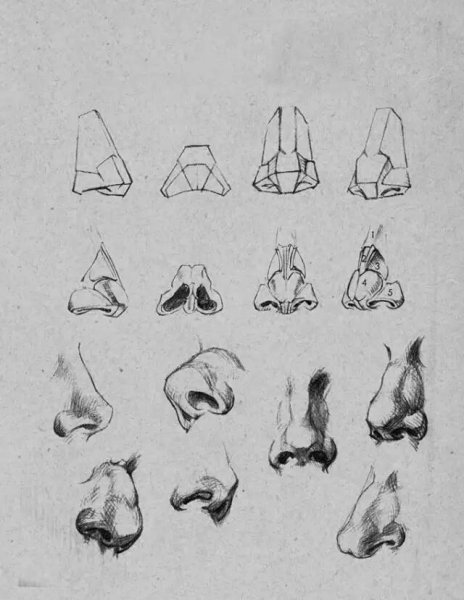 Ухо Давида гипс сбоку