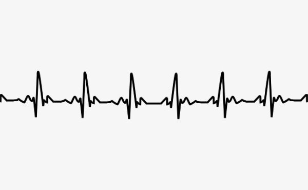 Линия кардиограммы