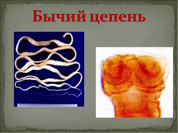 Тениаринхоз бычий цепень