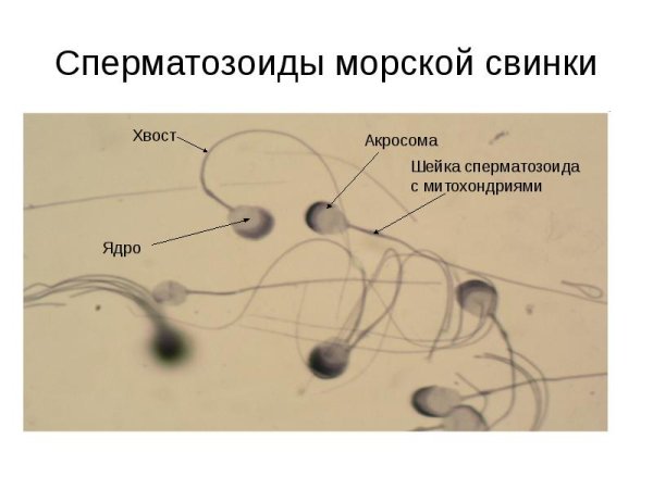 Сперматозоиды морской свинки Железный гематоксилин