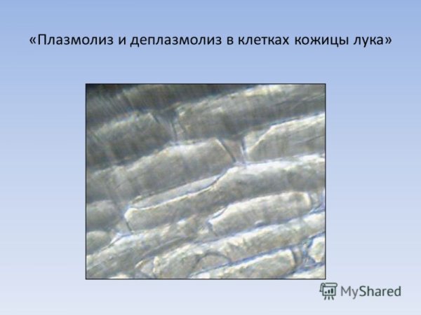 Плазмолиз в клетках лука