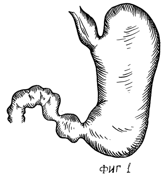 Желудок нарисовать