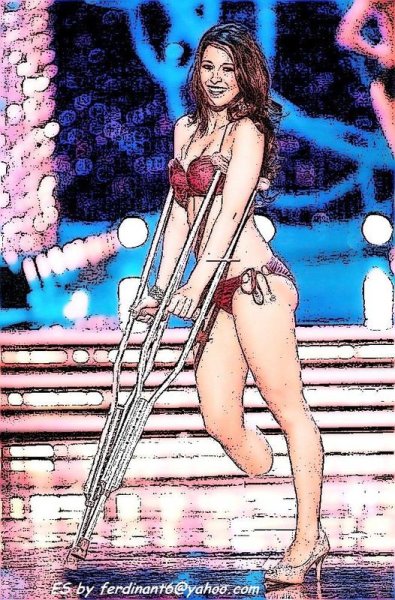 Девочка на костылях рисунок