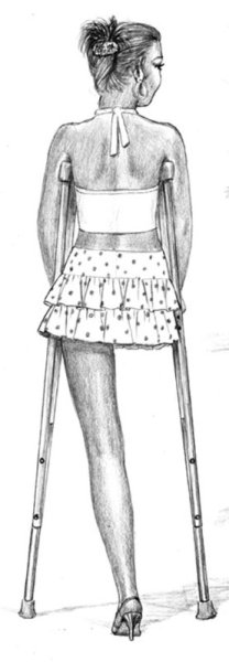 Ампути в изобразительном искусстве