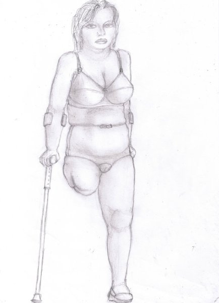 Ампути в изобразительном искусстве