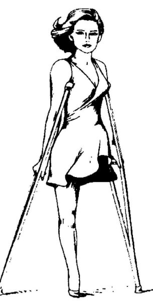 Ампути мультипликация