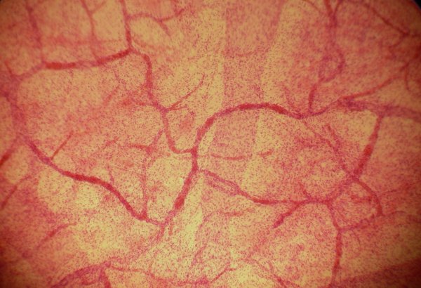 Сосуды микроциркуляторного русла гистология