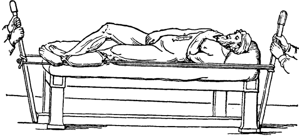 Скамья Гиппократа в древности