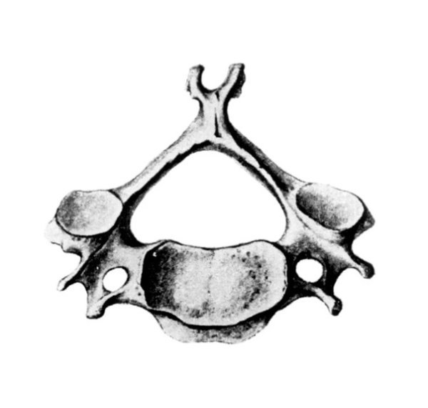 Шестой шейный позвонок строение