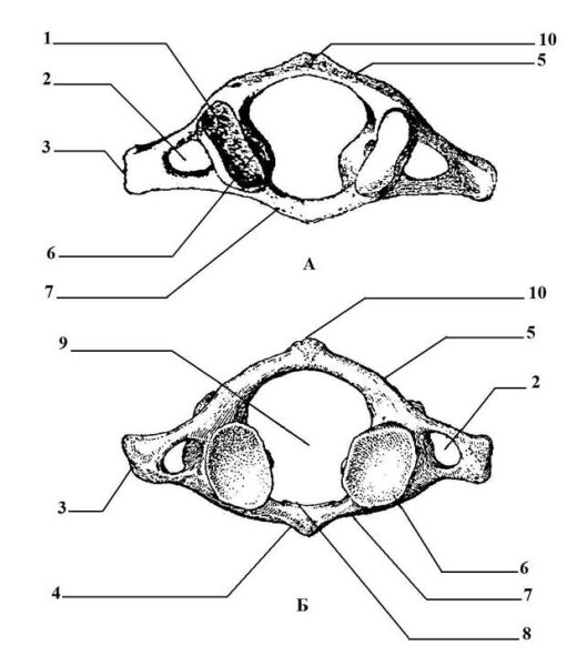 Первый шейный позвонок Атлант вид снизу