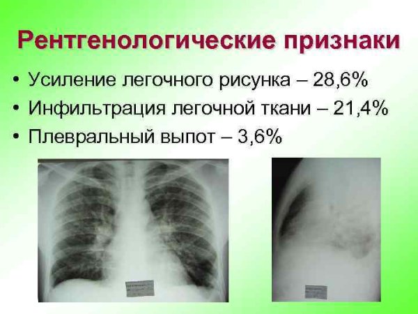 Усил ение логочного рисунка