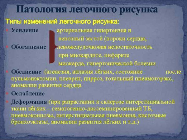 Что такое обогащение легочного