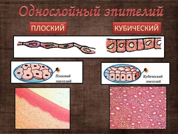 Многослойный неороговевающий цилиндрический эпителий