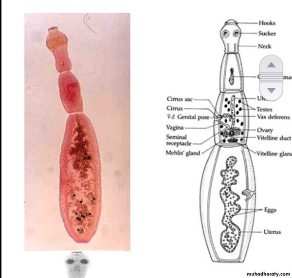 Echinococcus (Echinococcus granulosus) Morphology
