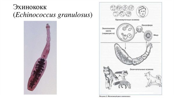 Эхинококкоз онкосфера