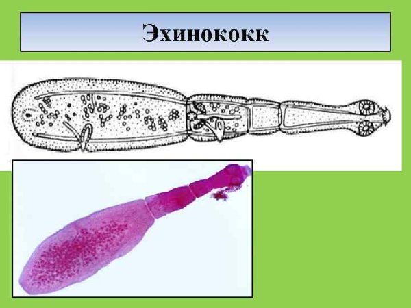 Ленточные черви эхинококк