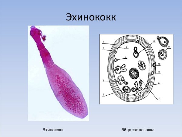 Эхинококковая Финна строение