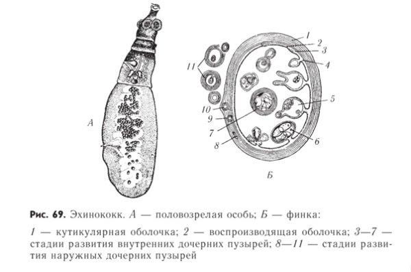 Строение кисты эхинококка