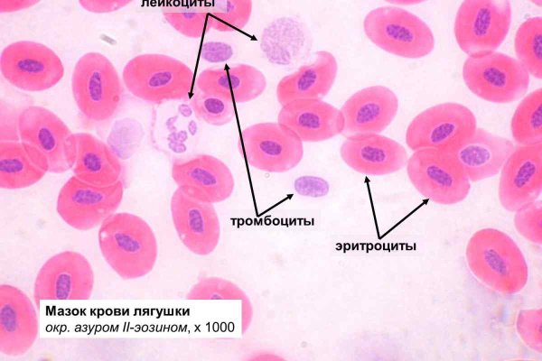 Микропрепарат крови лягушки